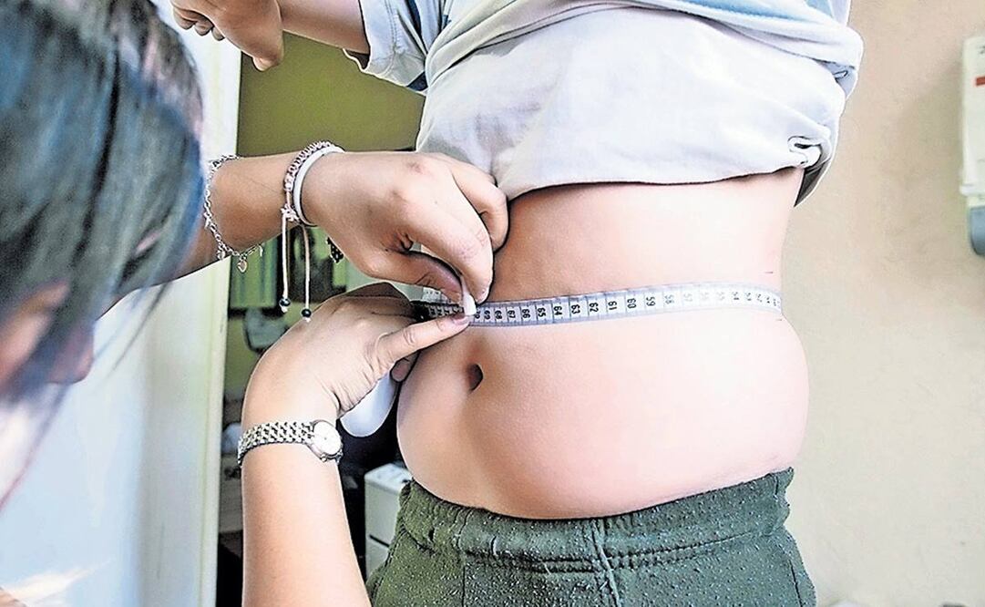 Especialista advierte que la obesidad afecta la salud física y mental (Foto: Archivo / EL UNIVERSAL)
