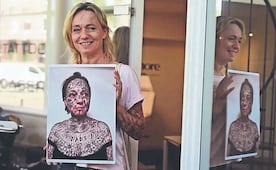 Su ex le tatuó su nombre 250 veces: Así logró borrar las marcas de años de violencia