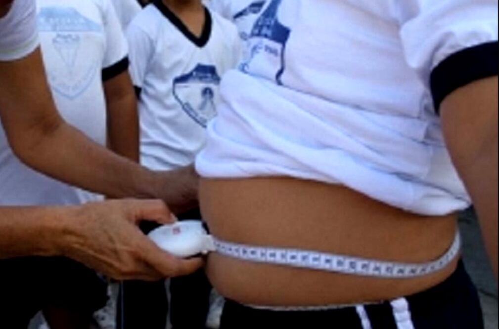 Kuri advirtió sobre un incremento sobrepeso en mujeres adolescentes, por el contrario los hombres en todos los rangos de edad realizan más actividades físicas. Foto: Archivo/EL UNIVERSAL