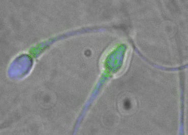 En el semen humano viven al menos 27 virus