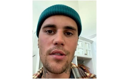 Justin Bieber revela que tiene la mitad del rostro paralizado: "manténganme en sus oraciones"