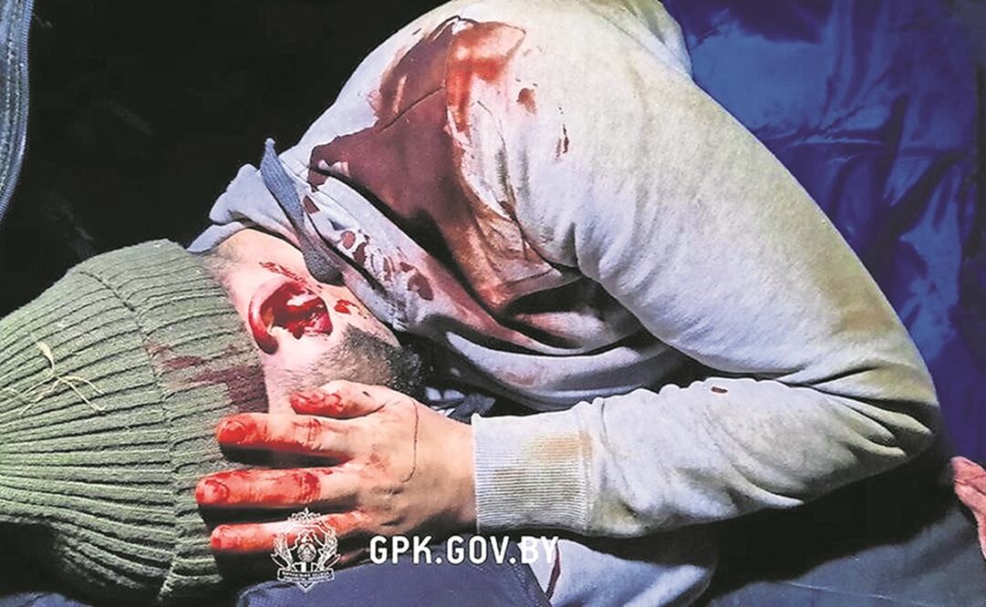 Un migrante herido en la frontera entre Bielorrusia y Polonia, cerca de Grodno. Foto: AP