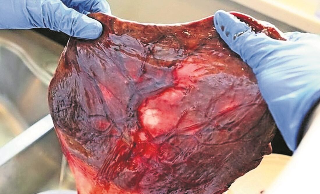 Foto: Archivo El Universal