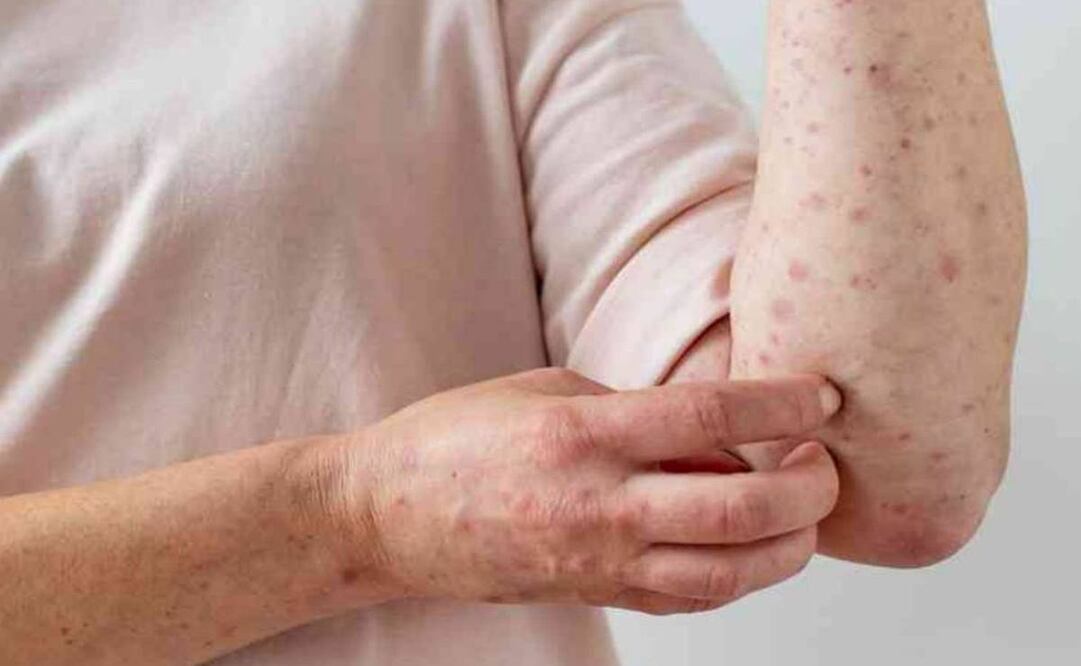 Foto: Archivo EL UNIVERSAL