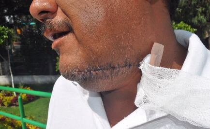 Dan alta a víctima de presunta 'Degolladora'