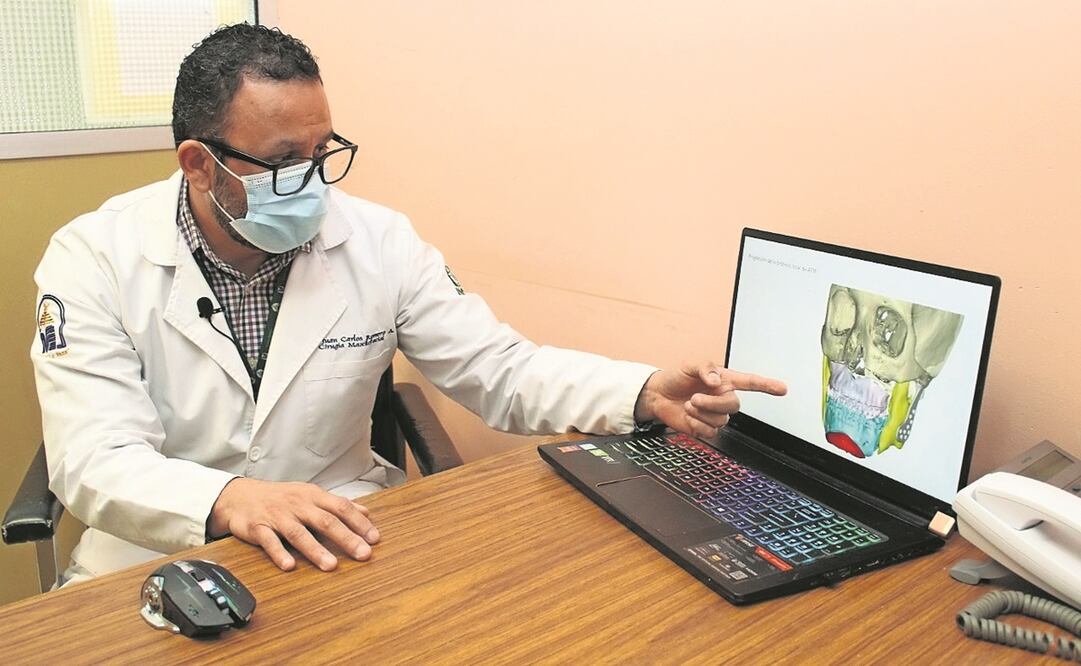 El procedimiento que empleó tecnología de impresión 3D consistió en fracturar y reposicionar los huesos de la cara. Fotos: ESPECIAL