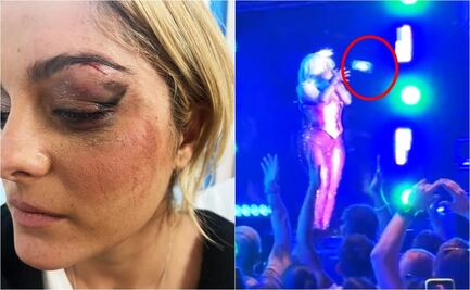 Bebe Rexha recibe puntos en la cara, tras ser golpeada con un celular; ya dieron con el agresor 
