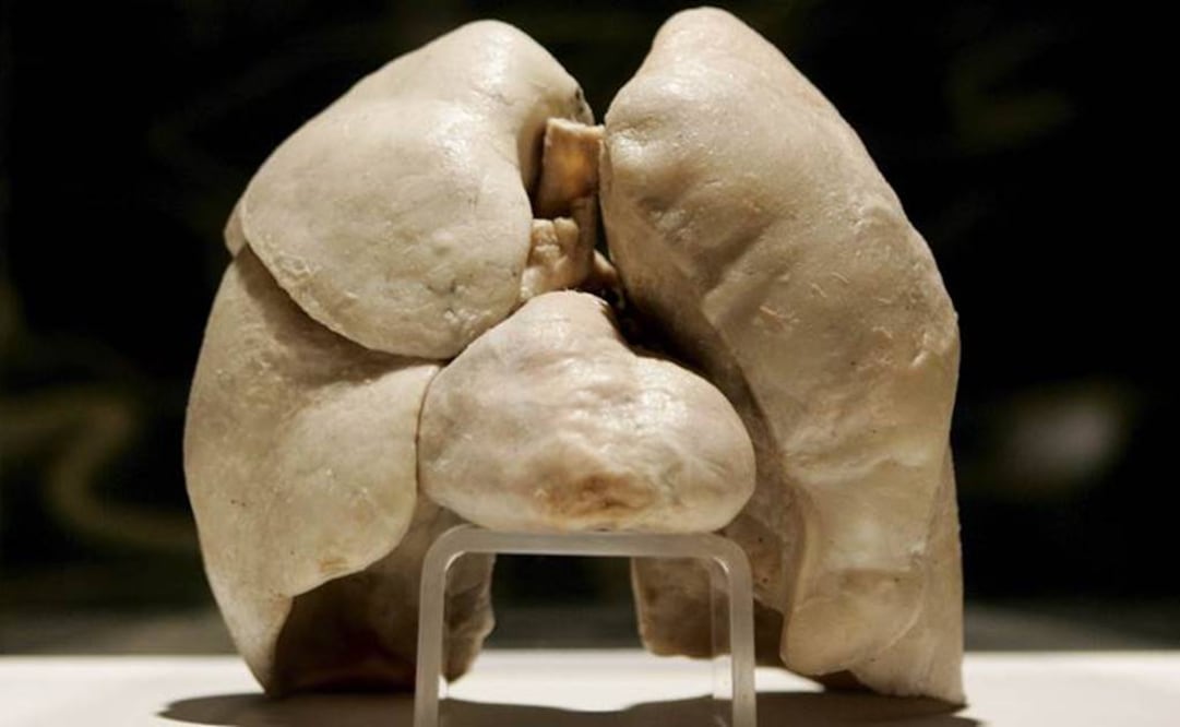 Las investigaciones se han hecho sobre modelos animales de ratón y muestras de tumores humanos. Foto: Archivo