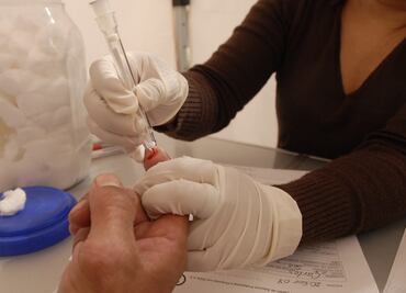 Análisis de sangre permite identificar un nuevo biomarcador del Alzheimer