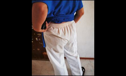 Tiran café hirviendo a enfermera; "nos vas a contagiar a todos", le gritan