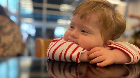 Otis, el niño que nació en el día internacional del síndrome de Down y cambió la vida de sus padres 