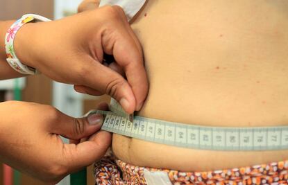 Obesidad y sobrepeso aumentan muertes prematuras: Ssa