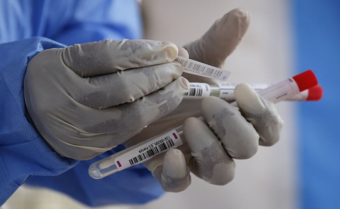 A laboratory technician prepares nasal swabs to be tested for the new coronavirus that causes COVID-19 – Photo: Brian Inganga/AP