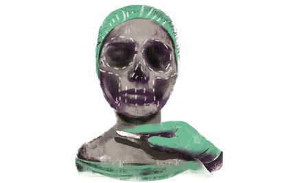 Han muerto 4 mujeres en cirugías plásticas; alertan riesgo por charlatanes