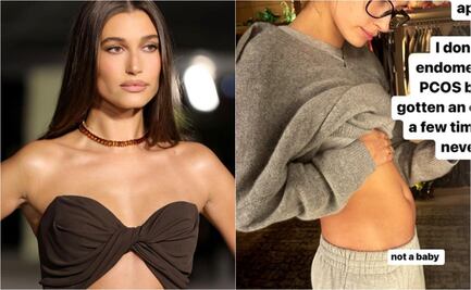 Hailey Bieber revela que es un quiste en los ovarios lo que hace que su vientre luzca abultado