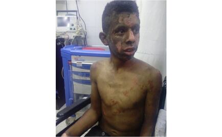 Se registra explosión en una vivienda de Texcoco; hay dos menores lesionados