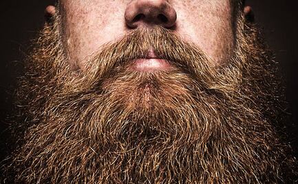 ¡Ten cuidado! La barba y los besos pueden ocasionar problemas a tu piel