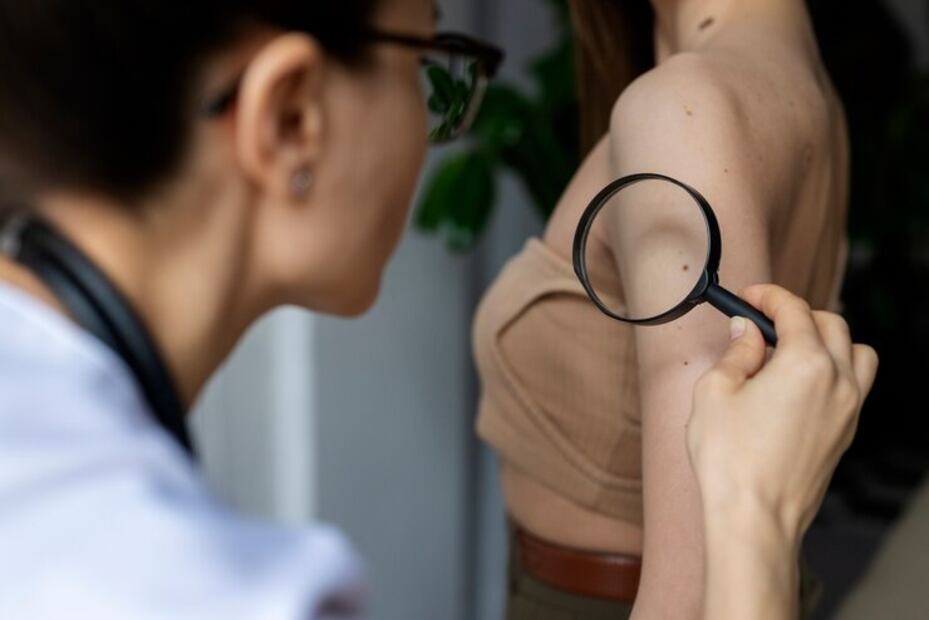 Qué es un lipoma. Fuente: Freepik