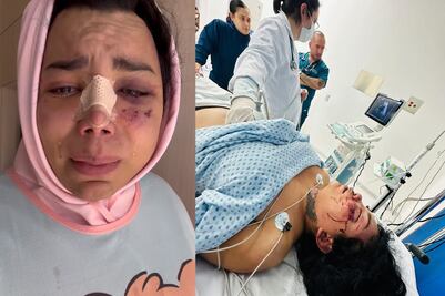 Dan de alta a Paolita Suárez del Hospital tras agresión de su pareja