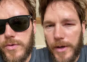 Eso de andar de valiente no le funcionó, abeja pica el ojo de Chris Pratt