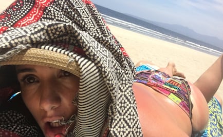 Betty Monroe muestra, en bikini, quemaduras por sol