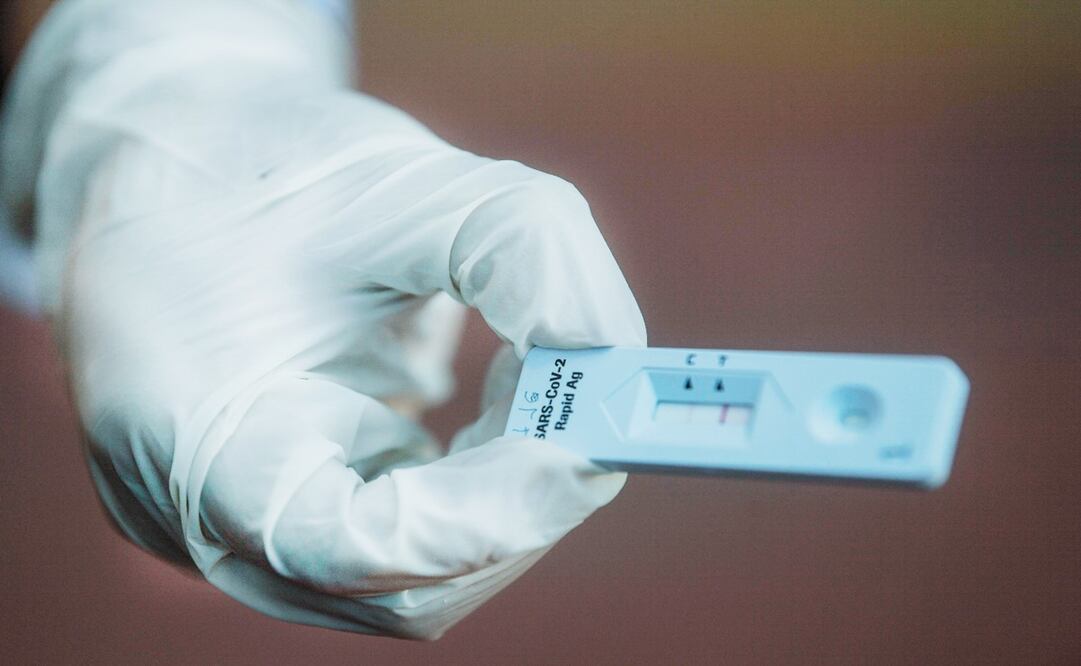 La demanda de pruebas para detectar la covid-19 ha crecido de manera exponencial. Foto: Pedro Pardo/AFP