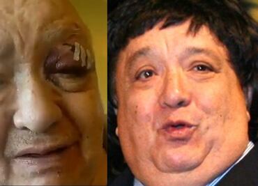 Luis de Alba, "El Pirrurris", sufre fuerte accidente en su domicilio