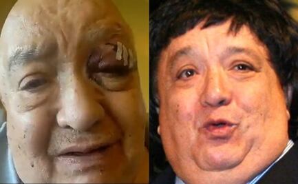 Luis de Alba, "El Pirrurris", sufre fuerte accidente en su domicilio