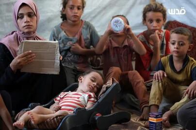 Bebé con las piernas paralizadas expone el drama ocasionado por la poliomielitis en Gaza