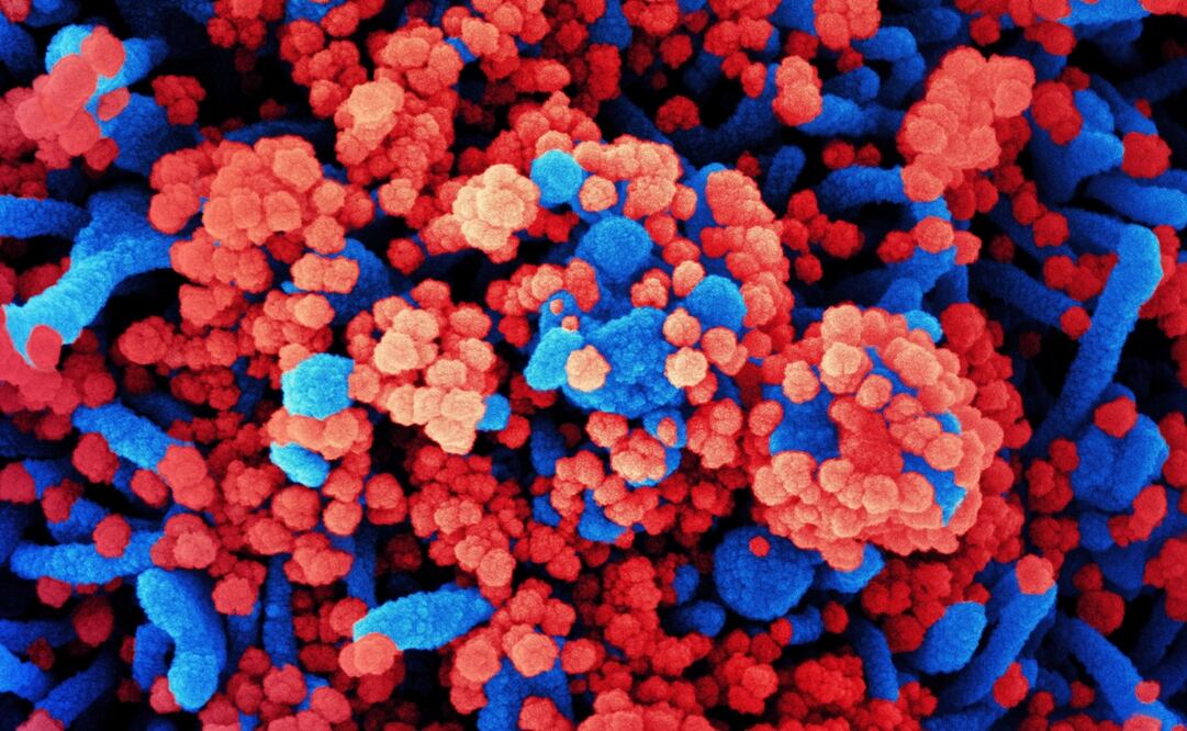 Foto: EFE/EPA/NIAID/NATIONAL INSTITUTES OF HEALTH 