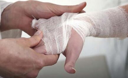 ​Descarta Ssa que lepra sea problema de salud pública