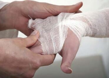 Descarta Ssa que lepra sea problema de salud pública