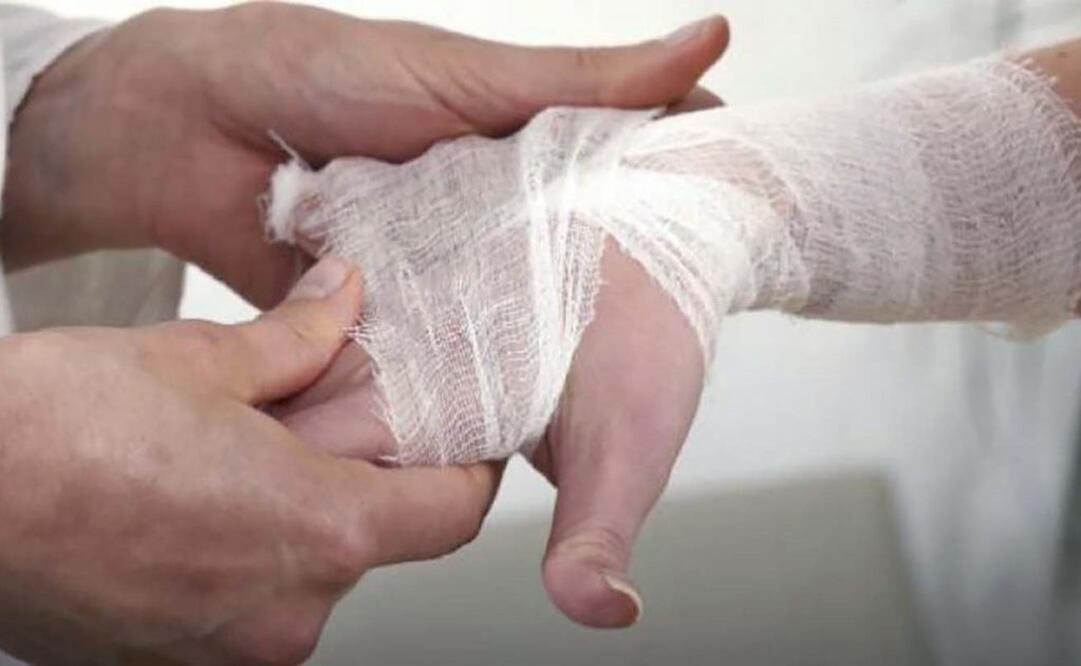 Hay una mayor incidencia de casos de lepra que carecen de los factores de riesgo tradicionales, lo que contribuye a aumentar la evidencia de que esa enfermedad "se ha vuelto endémica en el sureste de EU. Foto: Especial SSA