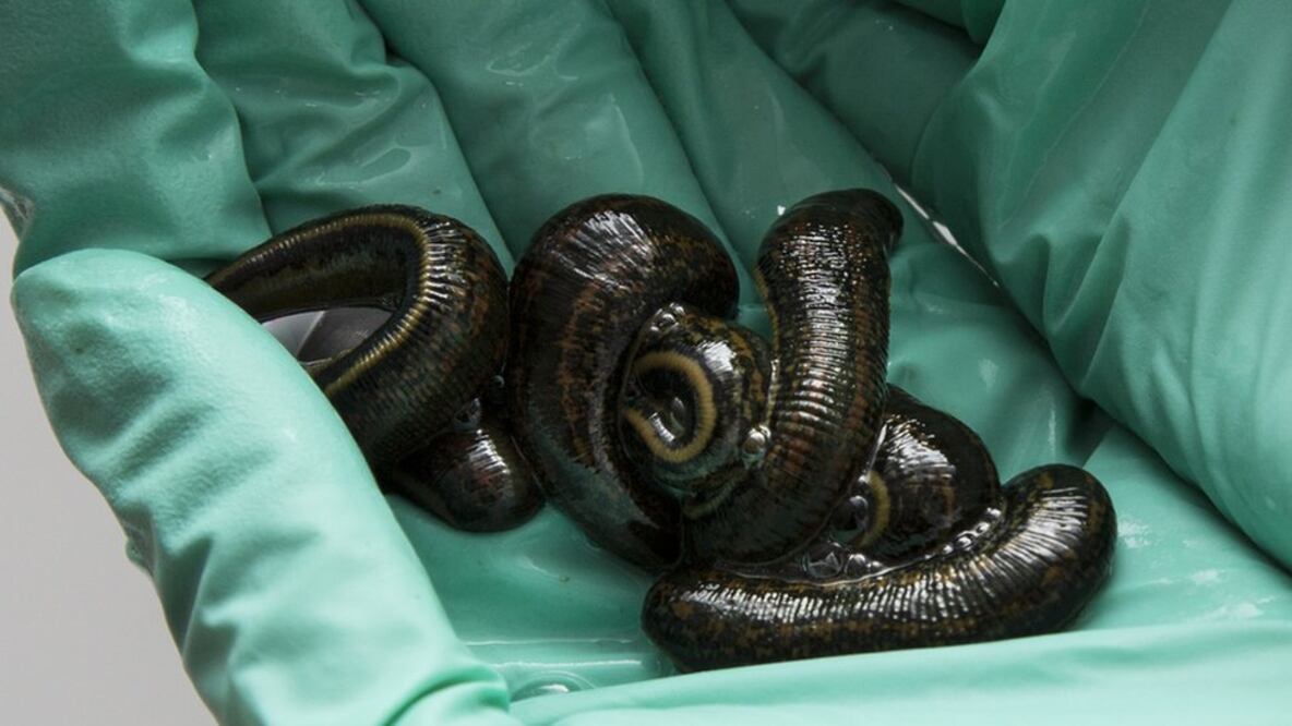 El hombre al que atraparon con casi 5 mil sanguijuelas en un aeropuerto de Canadá