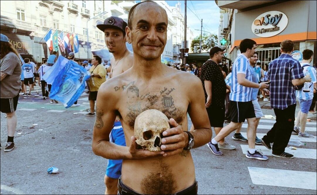 Aficionado de Racing con el cráneo. Foto: @FutbolEsquema