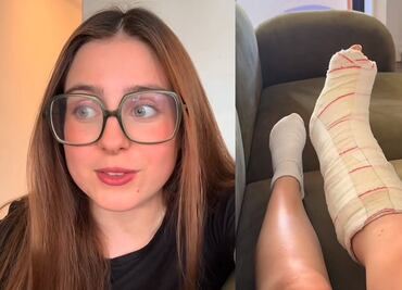 ¿RoRo Bueno participará en la La Velada del Año V tras fractura de pie?; influencer responde