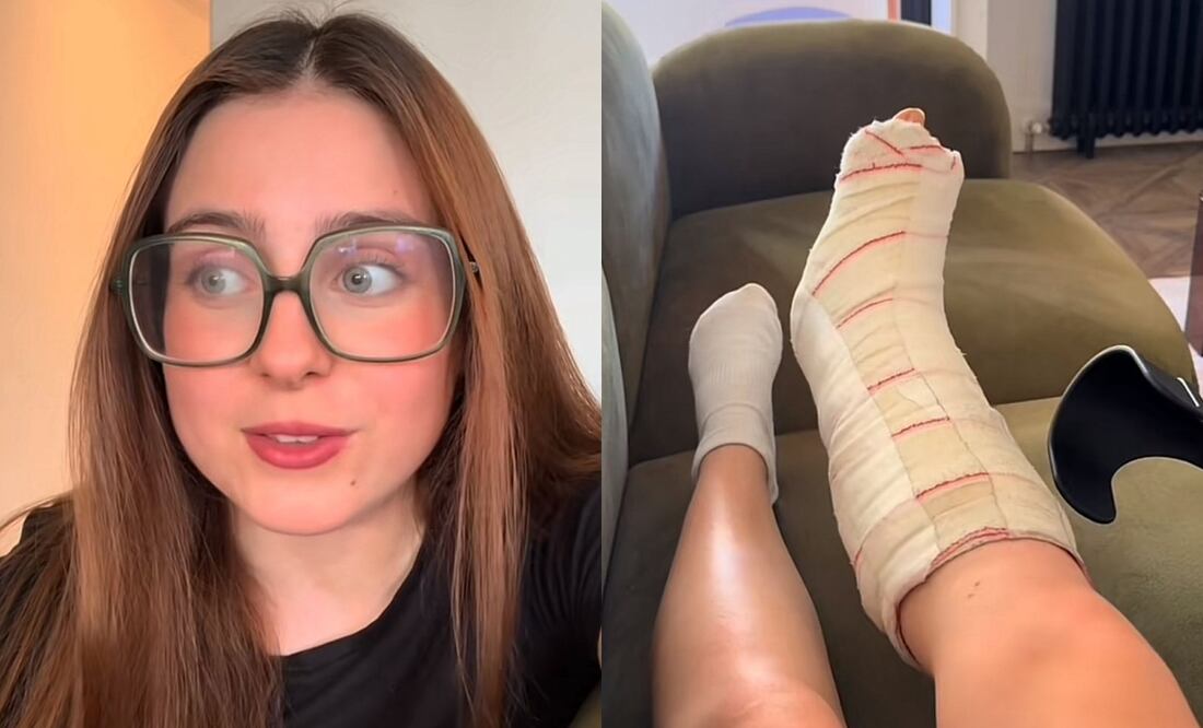 La tiktoker preocupó a sus seguidores al confirmar que sufrió una lesión. Foto: Redes Sociales