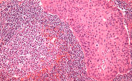 Mecanismo protege a las células del envejecimiento prematuro