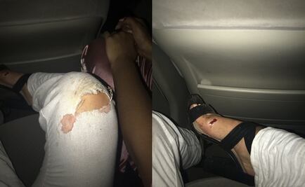 Usuaria de Uber salta de auto en movimiento; acusan a conductora de secuestro en Miami