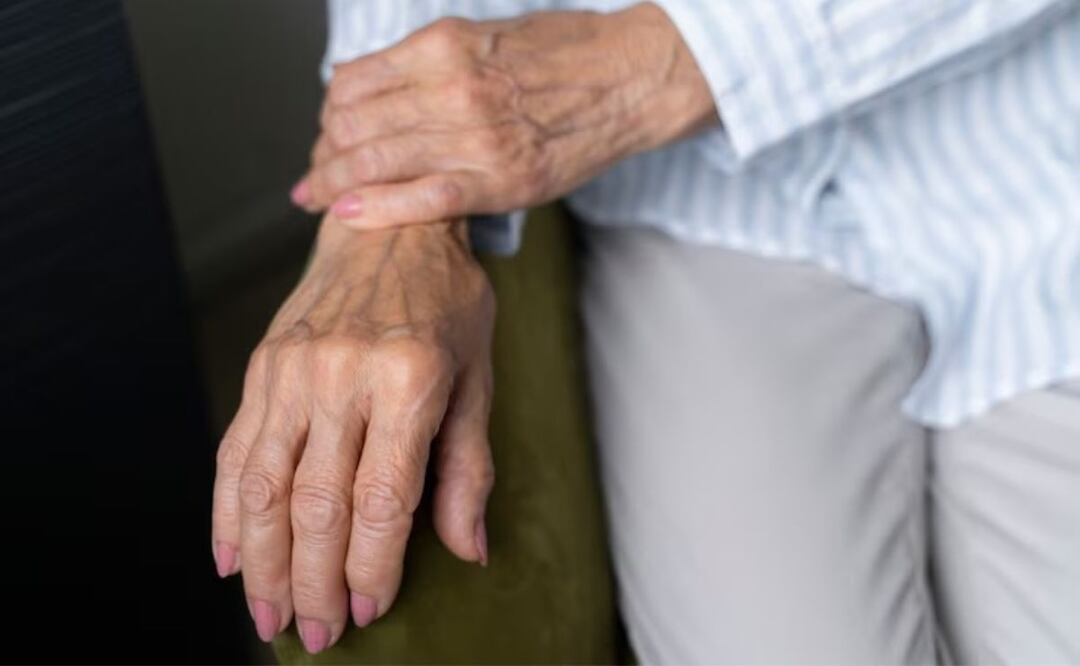 Un insecto para la artritis. Fuente: Freepik