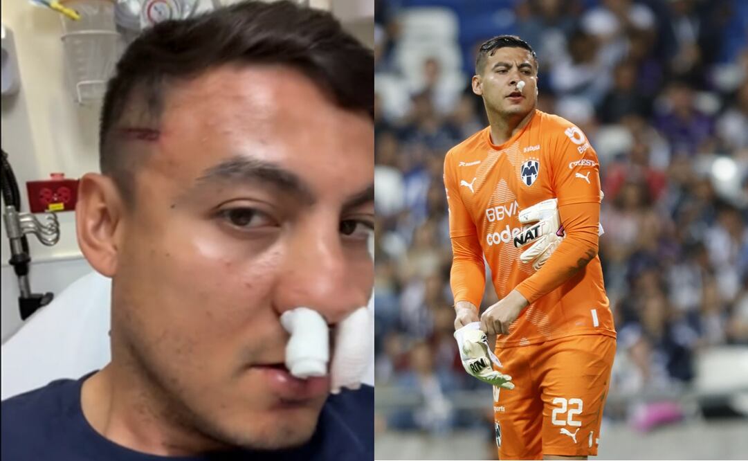 'Mochis' Cárdenas muestra sus heridas en redes sociales / Foto: Especiales