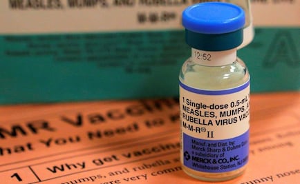 Descartan casos de sarampión en CDMX