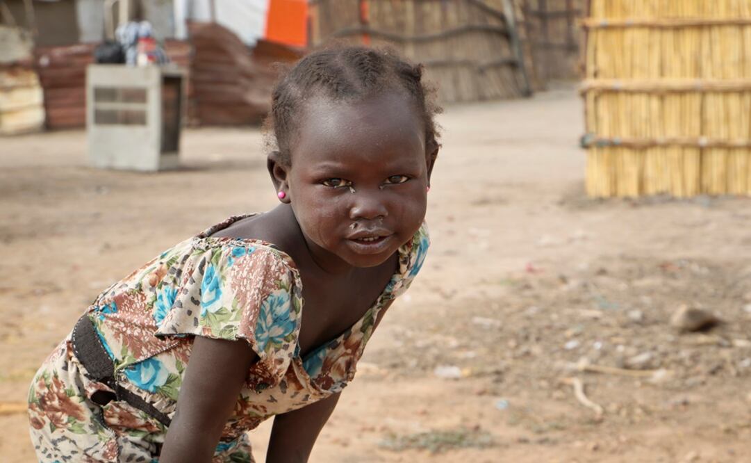 Female genital mutilation is a deeply rooted practice in Sudan and other countries in Africa, Asia, and the Middle East - Photo: Sam Mednick/AP