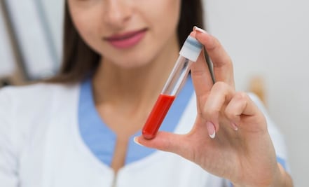 Conoce el nuevo análisis de sangre ideal para medir ácidos grasos omega-3