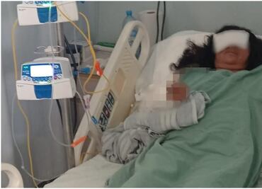 Maratonista de Oaxaca en riesgo de perder ambos brazos tras ataque de tres perros pitbull