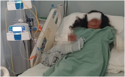 Maratonista de Oaxaca en riesgo de perder ambos brazos tras ataque de tres perros pitbull