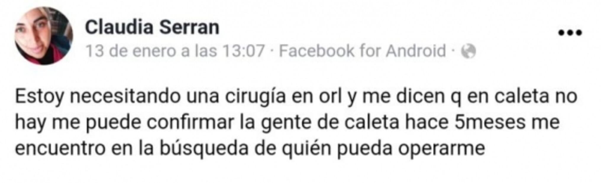 Mujer pierde el cartílago de su nariz luego de realizarse un hisopado contra el Covid-19
