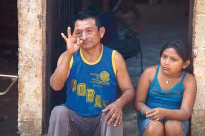 Duplica INER implantes cocleares a sordos