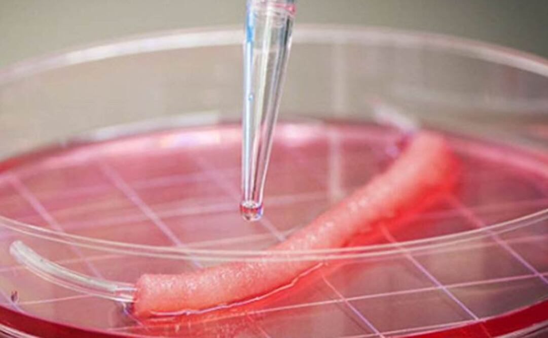 Macchiarini ha "actuado en una forma que ha tenido consecuencias muy trágicas para las personas afectadas y sus familias". Foto: