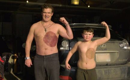 Papá canadiense pasa 30 horas tatuándose para simular marca de nacimiento de su hijo